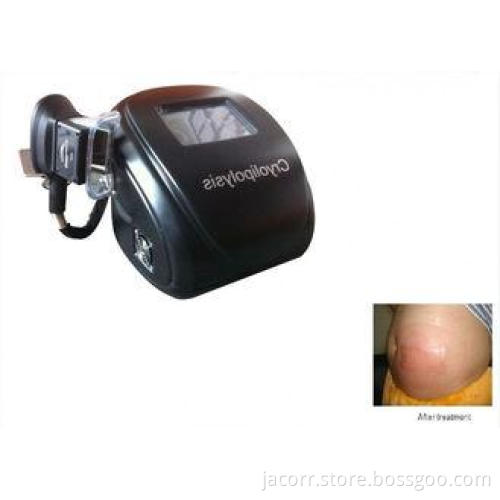 Cryolipolysis Velashape Portable Slimming Machine cool free